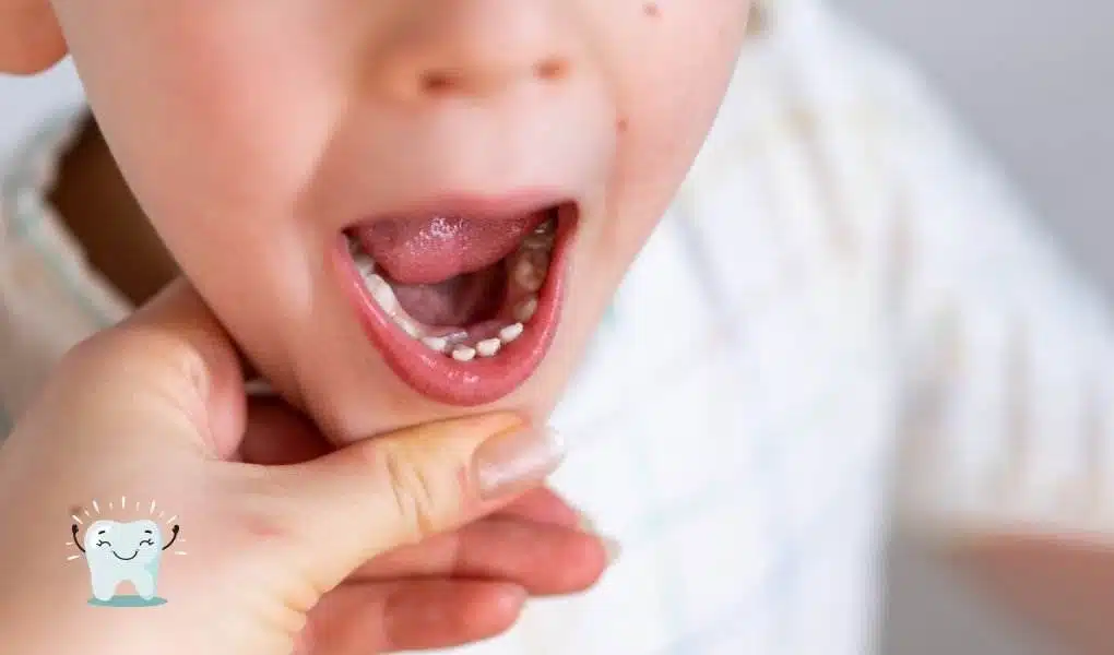 Troca dos Dentes de Leite