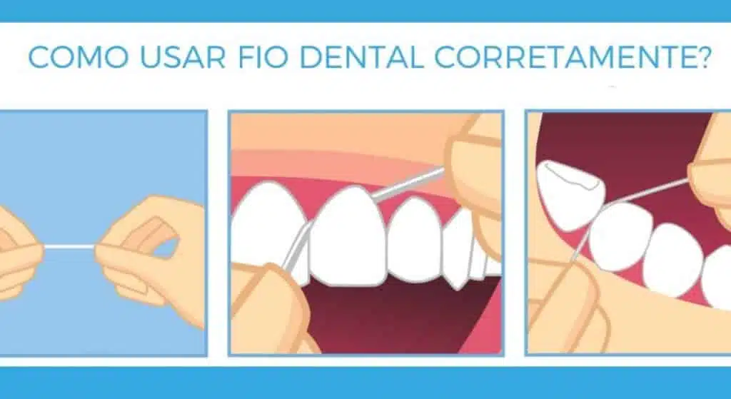 Como usar o fio dental corretamente