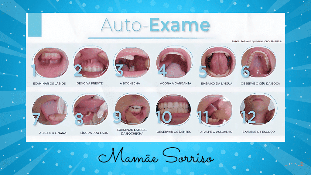 10-step guide to self-examination for oral cancer.