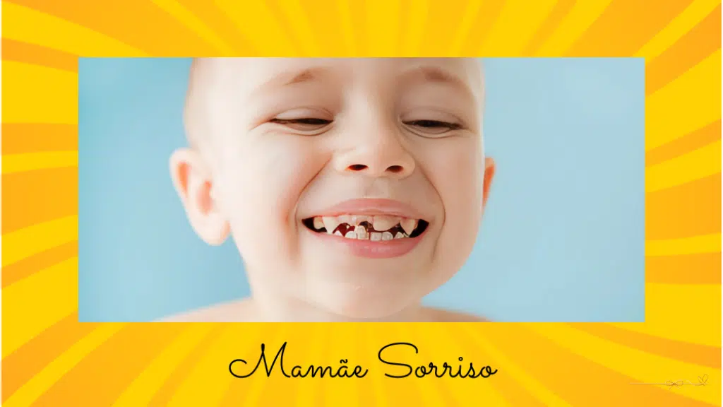 close no sorriso de uma criança com os dentes comprometidos pela cárie de mamadeira.