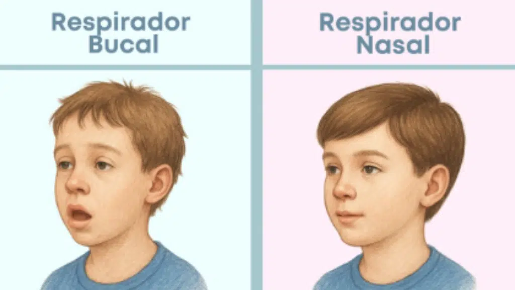 respirador bucal x respirador nasal